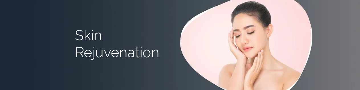 Acne Treatment in Delhi